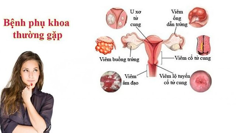 Các bệnh phụ khoa thường gặp