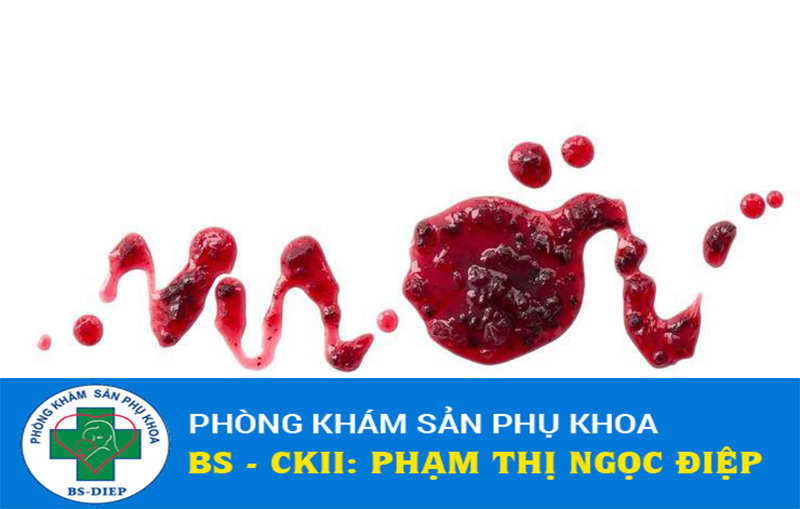 Các dấu hiệu sảy thai