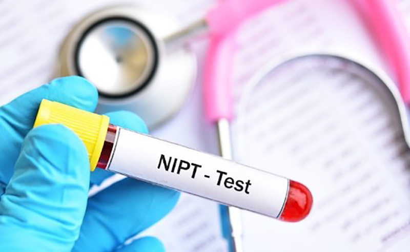 Có nên xét nghiệm Nipt