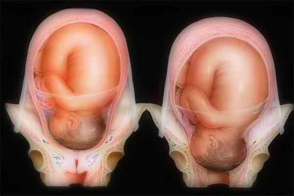 co-tu-cung-ho-ngoai Hở ngoài cổ tử cung rất nguy hiểm nếu thai nhi chưa đủ tháng