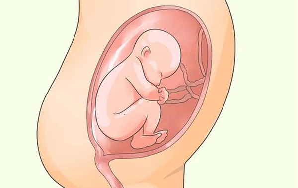 Mẹ bầu bị đa ối thường được chỉ định sinh luôn vào tuần 36, 37 khi bé đã phát triển hoàn thiện