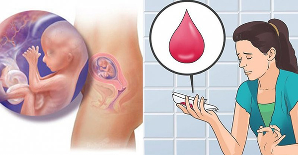 Dấu hiệu sảy thai 5 tuần đầu