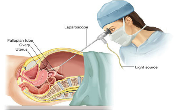 dieu-tri-sa-sinh-duc điều trị sa sinh dục