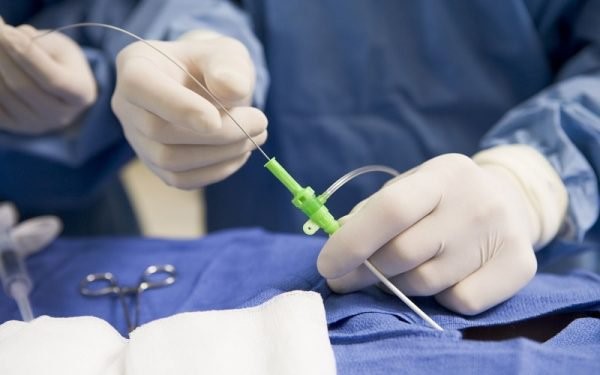 Đốt viêm lộ tuyến cổ tử cung
