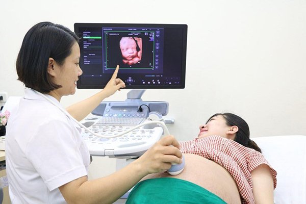 gia-sieu-am-4d-1 Siêu âm 4d