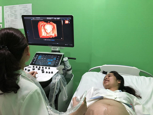 Khi nào siêu âm 4d