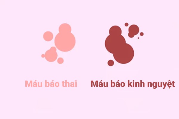 Máu báo thao khác máu kinh