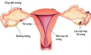 Niêm mạc tử cung mỏng