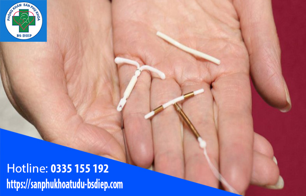 sau sinh bao lâu thì đặt vòng được