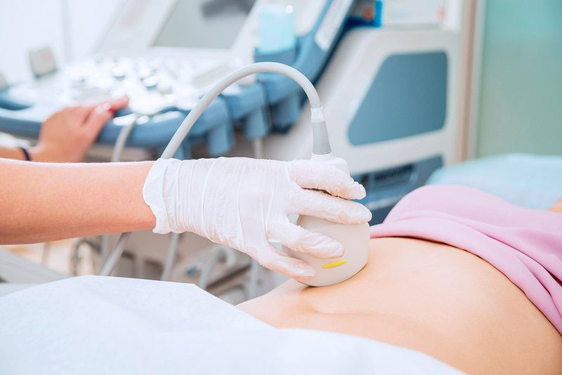 Siêu âm thai 4 tuần tuổi