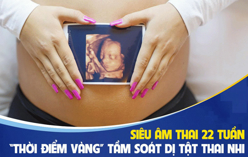 Siêu âm tuần 22