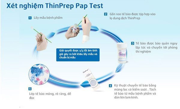 Tầm soát ung thư tử cung