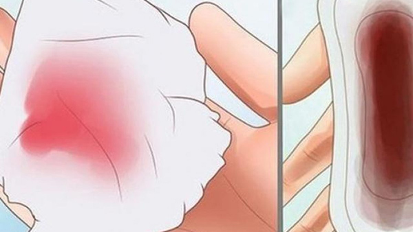 Tử cung ra máu bất thường