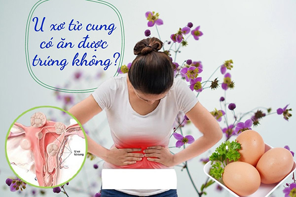 u-xo-tu-cung-co-duoc-an-trung-khong Bị u xơ tử cung có được ăn trứng không?