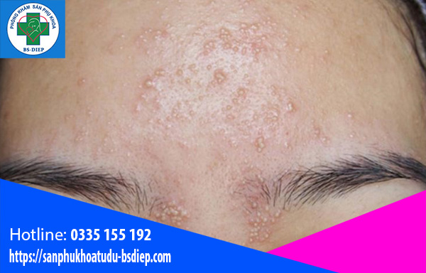 Vấn đề về da