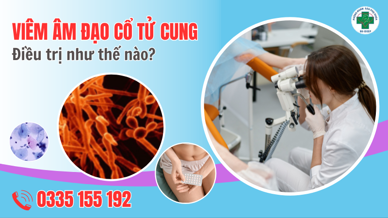 U Nang