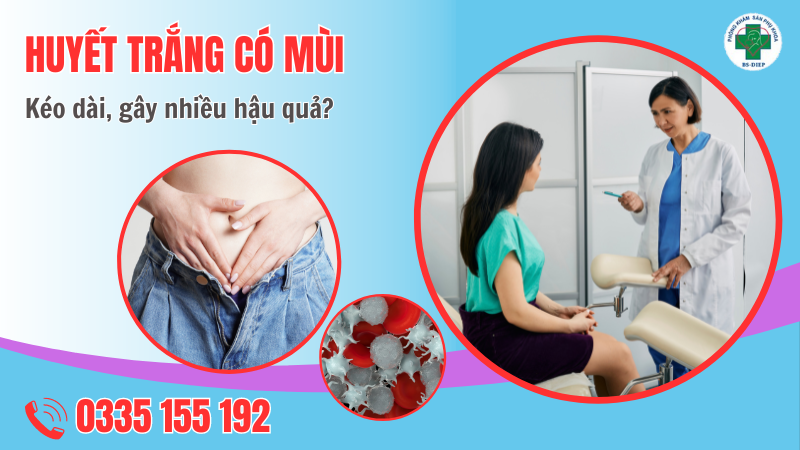 Huyết trắng