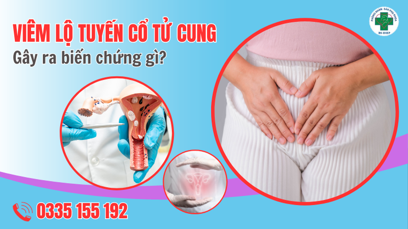 U Nang
